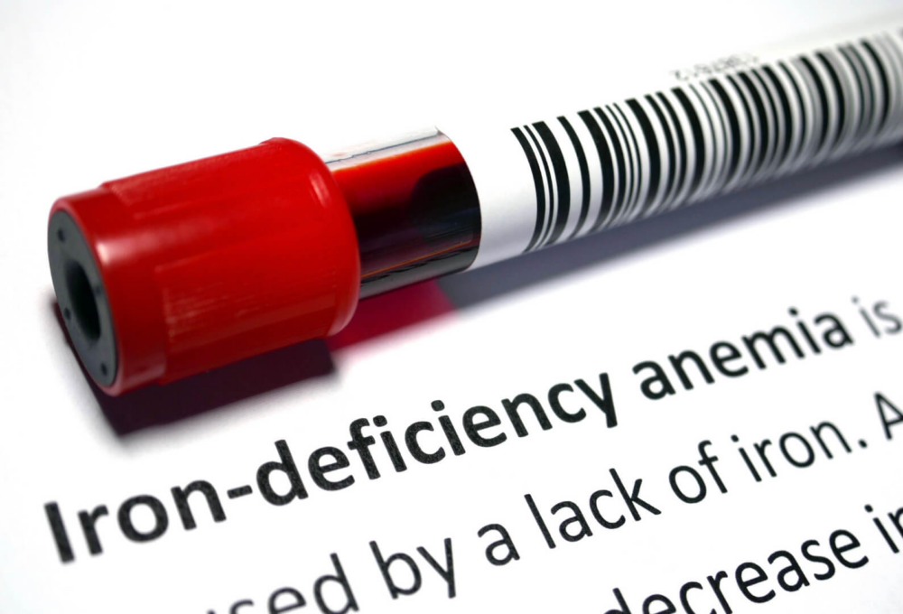 Anemia & Iron Deficiency Symptom Checker, Instant PDF Download