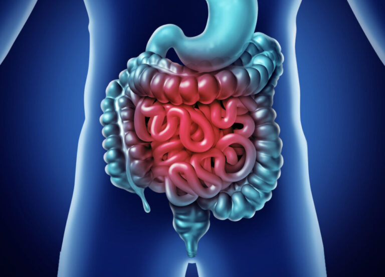 a close up image of an inflamed small intestine with Crohn's disease