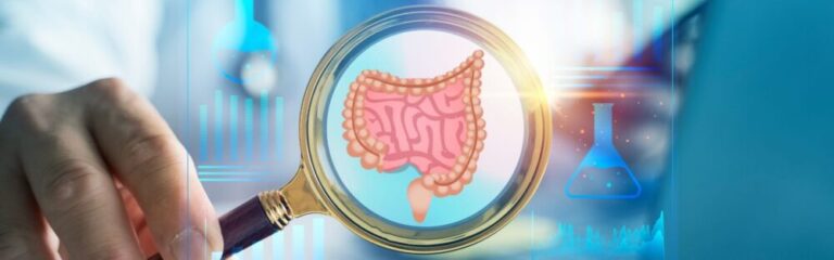 Medical illustration showing a magnified view of the large intestine (colon), representing ulcerative colitis and digestive health